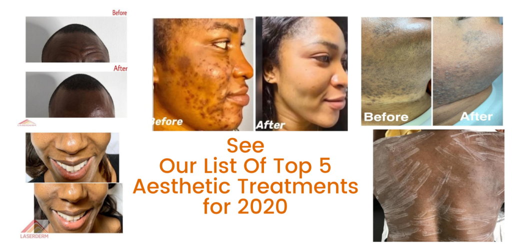 See Our List Of Top 5 Aesthetic Treatments for 2020