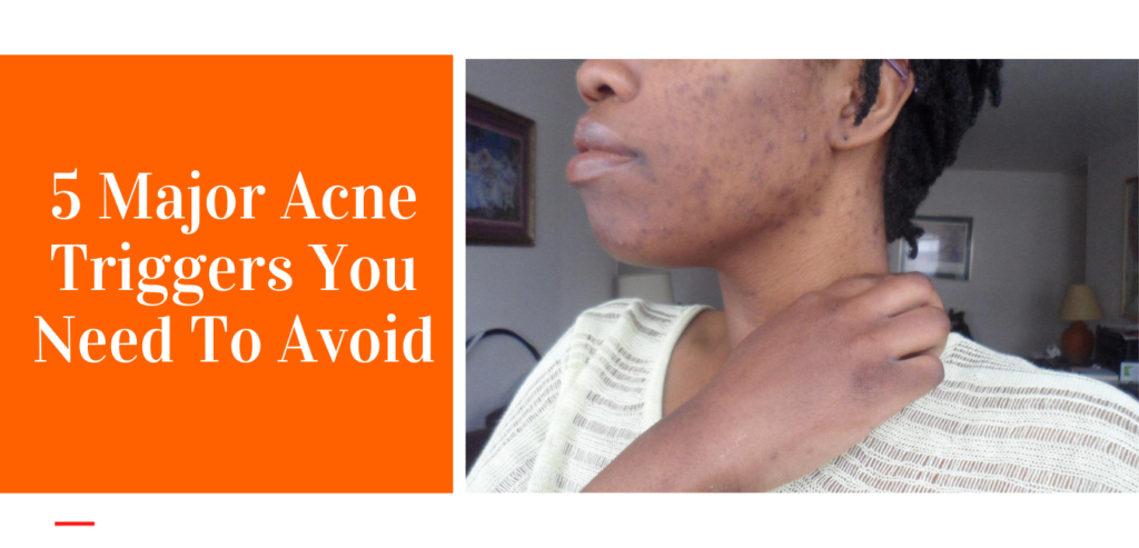 5 major acne triggers you need to avoid