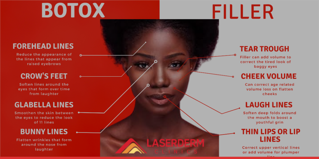 Botox_Fillers_Procedure_LaserDerm Clinics